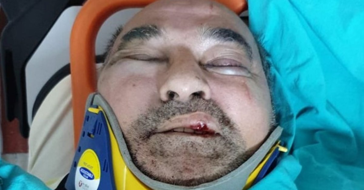 Gazeteci Ergün Poyraz saldırıya uğradı