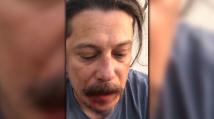 Alman Gazeteciler Birliği'den Erk Acarer'e yönelik saldırıya kınama