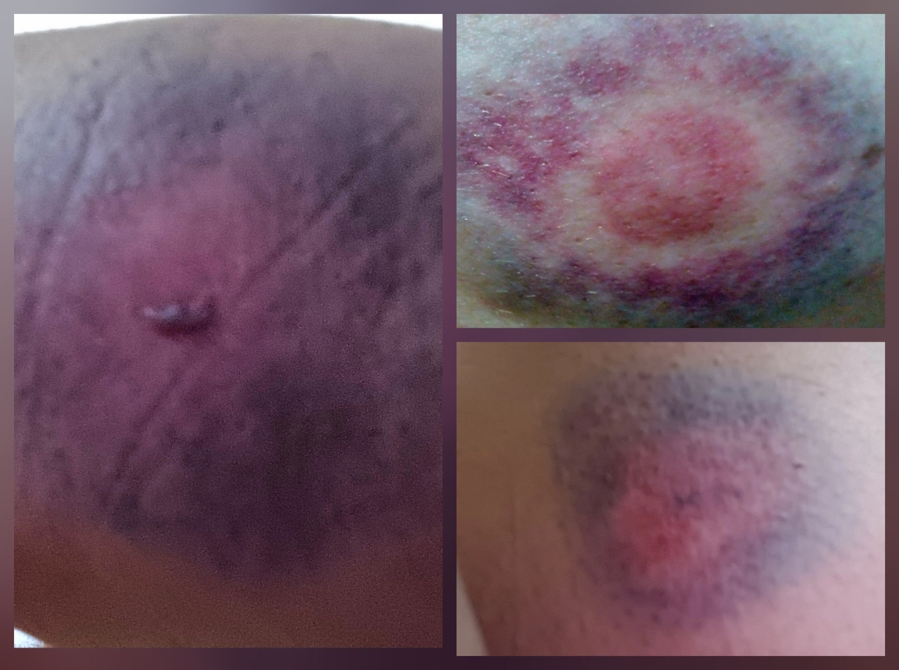 Polis, Gazeteci Fatoş Erdoğan'ı yaraladı