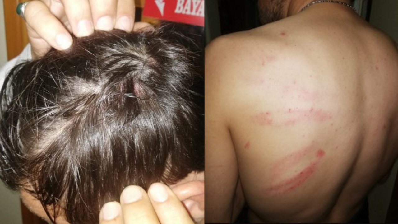 Samsun'da usulsüzlükleri ortaya çıkaran gazeteciye doğalgaz borusuyla şiddet uyguladılar!