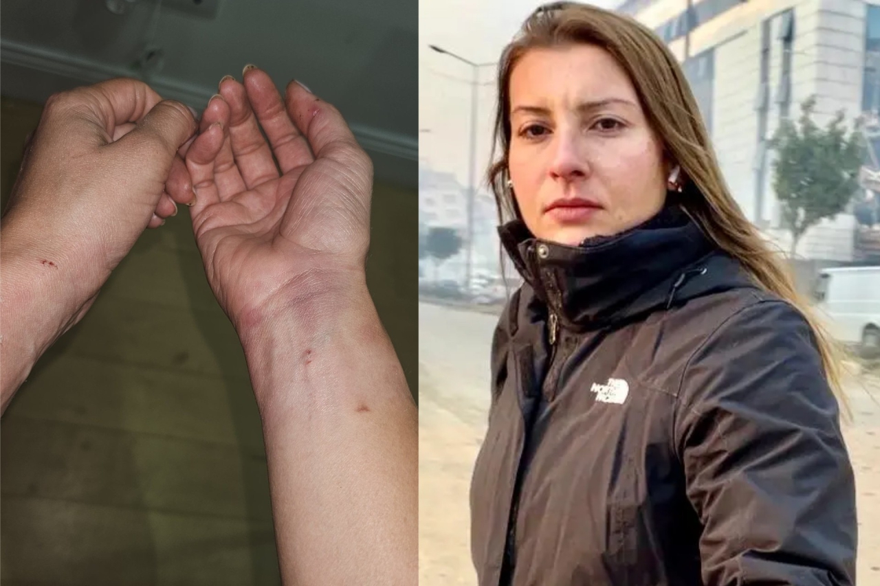 Gürültü ihbarı gerekçesiyle kadın gazeteci darp edildi