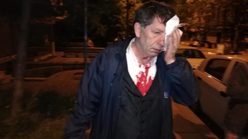 Yavuz Selim Demirağ’a saldırı davası ip yumağına döndü